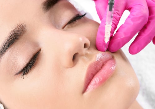 Can Estheticians Legally Perform Fillers in Florida?